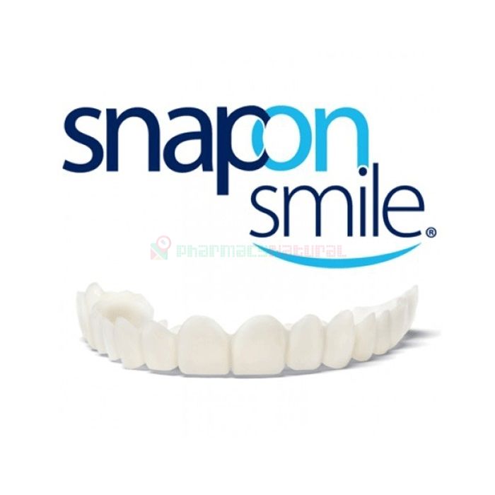 Snap-On Smile - veneers in Litvinov